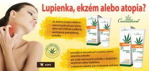 Atopos